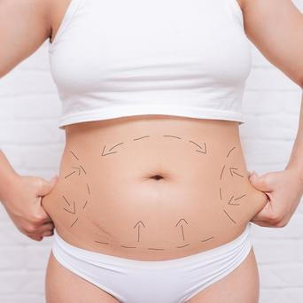 Plánování plastické operace / liposukce